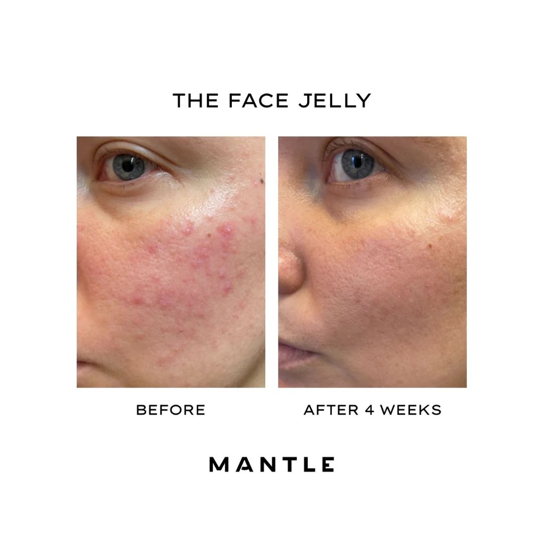 The Face Jelly